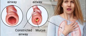 Asthma Treatment 1