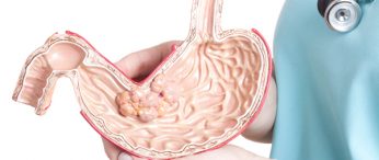 Gastric Treatment